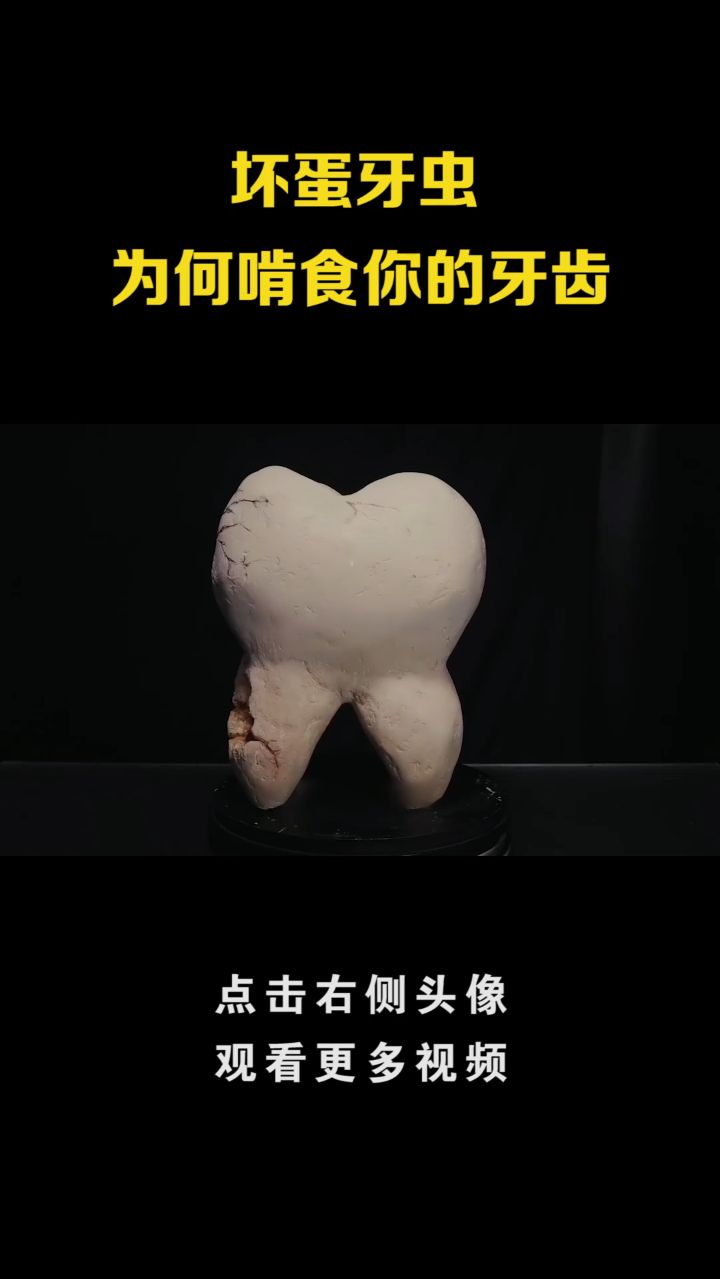 恐怖模型：巨型恶臭牙虫，正在疯狂啃食你的牙齿