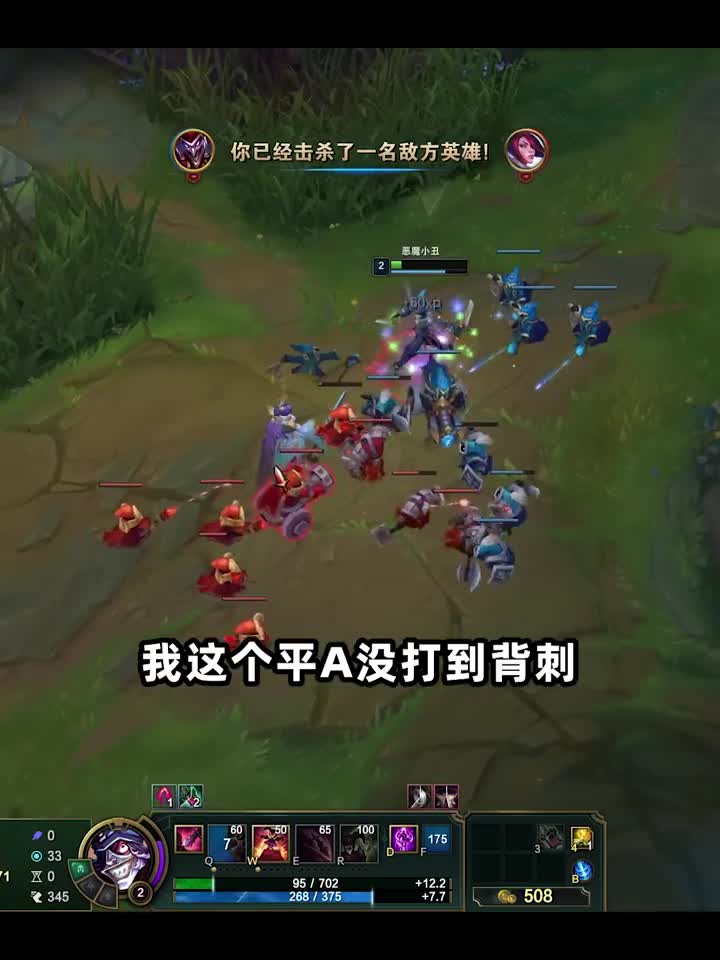 你超模你就看不起我？！