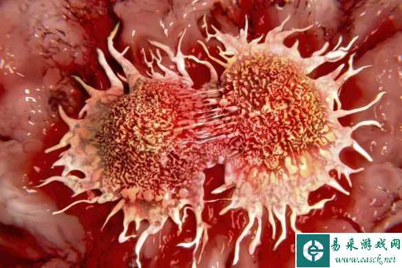 以色列开发出诱导癌细胞"自杀"疗法 会留下健康细胞