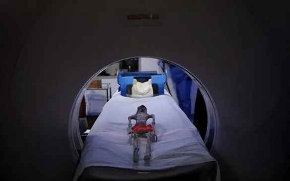 墨西哥“外星人干尸”未经组装 已进行X光和CT扫描！