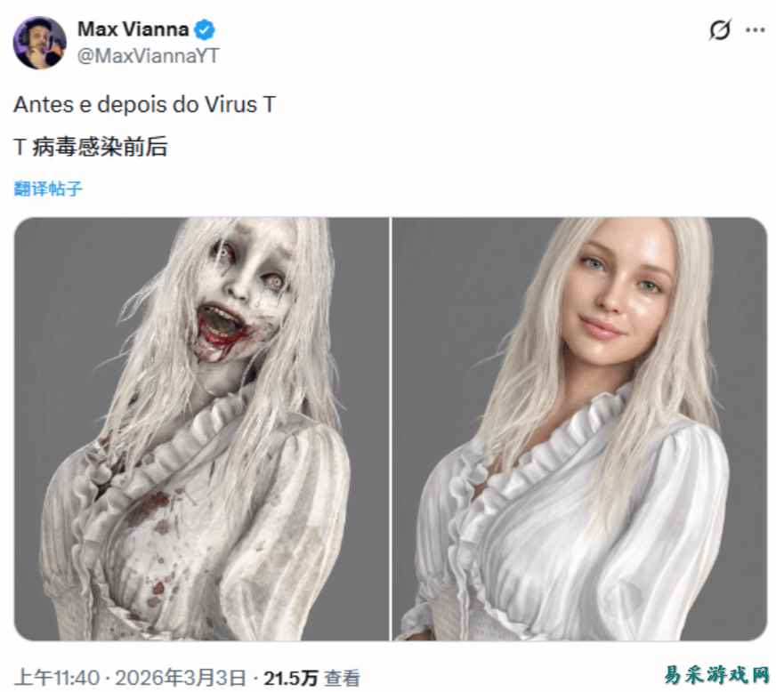 完蛋我被丧尸美女包围了，《生化危机9》美女感染病毒前后引热议